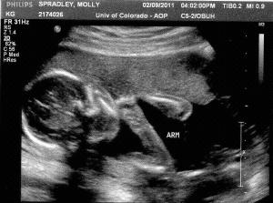Baby's Head and Arms Week 19